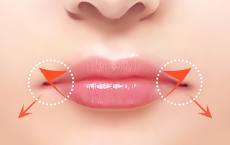 Best Lip Augmentation Doctors in Sonepat